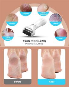 img 2 attached to 🦶 Rechargeable Electric Callus Remover with 3 Replacement 1500mAh Batteries - Smartideal Portable Electronic Foot File Pedicure Tool for Professional Foot Care and Dead Skin Removal