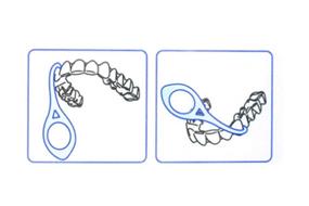 img 1 attached to Невидимые брекеты для правильного выравнивания зубов