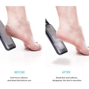 img 3 attached to Revitalize Your Feet with the KENED Feet Scrubber Dead Skin 👣 5 Pack - Professional Pedicure Kit for Effective Callus Removal and Feet Care