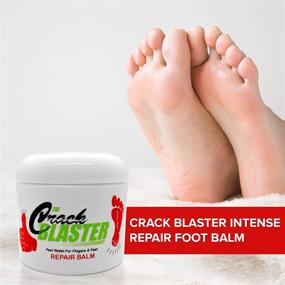 img 3 attached to 👣 Crack Blaster Repair Balm: Multi-Purpose Dry Skin Treatment for Cracked Heels, Dry Hands, Fingers, and Elbows | Fragrance-Free Intense Repair Therapy for Dry, Cracked Skin