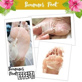 img 3 attached to 💎 Transform Your Feet with Summer Foot Premium Gold Edition Foot Mask - Exfoliating Peel & Callus Remover for Baby Soft Feet