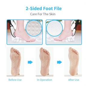 img 2 attached to 👣 13-in-1 Professional Pedicure Kit by SOFYE - Double Sided Foot Files Set, Exfoliating and Preventing Dead Skin, Salon Pedicure Tools, Washable & Effective Foot Skin Care Tools