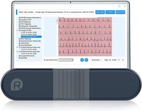 img 4 attached to Wellue Monitor Analysis Chargeable Recorder