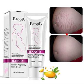img 3 attached to Mango Stretch Marks and Scar Cream - Pregnancy Stretch Marks and Scar Removal Cream | Belly Cream for Stretch Marks and Wrinkles | Obesity Stretch Mark Moisturizing Cream | Remove Marks (40g)