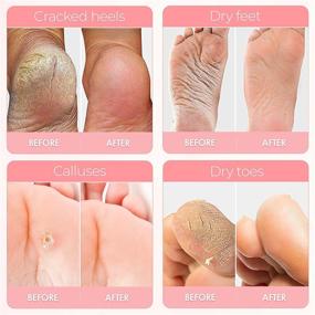 img 3 attached to 👣 Exfoliating Foot Peel Mask - Repair Cracked Heels, Remove Dead Skin, and Calluses - Silky Soft Feet Treatment - Natural Peeling for Dry Toe Skin - 2 Pack, Women's Sizes 5-11