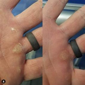 img 1 attached to 🤛 Набор по уходу за кожей рук CaliCure Callus Remover: Восстановите порванные руки после занятий гимнастикой, кроссфитом, скалолазанием!