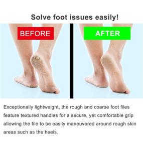 img 1 attached to 🦶 Dual-sided Stainless Steel Foot File - Callus Remover for Colossal Dead Skin Removal - Pedicure Scrubber Tool for Exfoliating, Smoothing, and Softening Dry/Wet Feet - Ideal for SEO