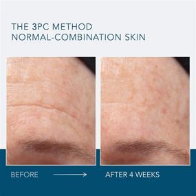 img 2 attached to 🧖 Dr. Lancer Dermatology Skincare: The Method - Cleanse for Normal-Combination Skin, 4.05 FL OZ, 3-Month Supply, Daily Use, Cleanse Impurities, 3-Step Routine