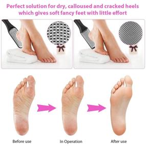 img 1 attached to 👣 UOWGA Professional 20-in-1 Pedicure Kit: Stainless Steel Foot Rasp, Foot Peel, Callus Clean Feet, Dead Skin Tool Set with Nail Clipper - Ideal Self-Care Gifts for Women