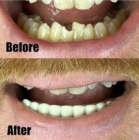 img 1 attached to Усовершенствуйте свою улыбку с Instant Smile Comfort Fit гибкими нижними зубами.