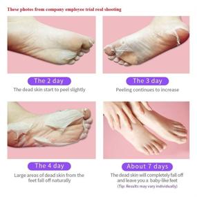 img 1 attached to YOUPINWEI Exfoliating Foot Peel Mask: Remove Calluses and Dead Skin, Achieve Silky Smooth Baby Soft Feet in 7 Days! (2 Pairs/Box)