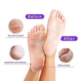 img 3 attached to YOUPINWEI Exfoliating Foot Peel Mask: Remove Calluses and Dead Skin, Achieve Silky Smooth Baby Soft Feet in 7 Days! (2 Pairs/Box)