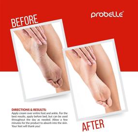 img 2 attached to 👣 Probelle Advanced Total Foot Cream: Ultimate Soothing & Hydrating Treatment for Rough, Dry, Cracked & Sore Feet – 3 Ounces