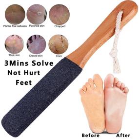img 3 attached to 🦶 Kinepi Foot File Callus Remover: Professional Pedicure Tool for Smooth and Soft Feet, Removes Cracked Heels, Dead Skin, Corn, and Hard Skin - Wet and Dry Use