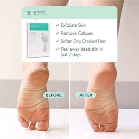 img 3 attached to 👣 Получите нежные ножки младенца с Patchology PoshPeel Pedi Cure - Интенсивная маска для педикюра от мозолей и сухой треснувшей кожи на ногах.