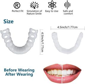 img 3 attached to Veneers Dentures Socket Imperfect Improve