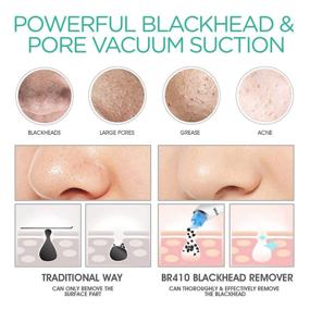 img 2 attached to 🧖 Get Clearer Skin with VOYOR Blackhead Remover Pore Vacuum - Electric Face Vacuum Pore Cleaner Acne White Heads Removal - 6 Suction Head BR410