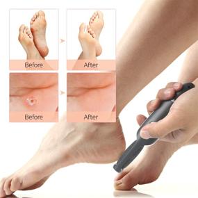 img 3 attached to 🦶 ABKO Rechargeable Cordless Foot File CR01 - Electric Callus Remover for Dead Hard Skin, Cracked Heels, Pedi Feet Care - Gray