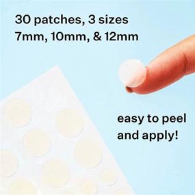 img 2 attached to Peach Slices Acne Spot Dots - Hydrocolloid Pimple Patch for Zits and Breakouts | Treats, Drains, and Shrinks Blemishes | Vegan & Cruelty-Free | 3 Sizes 7mm, 10mm, 12mm (30 Count)
