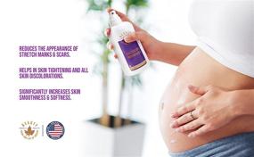 img 3 attached to Elegant Beauty Stretch Mark Cream - Advanced Hydration and Smoothing Formula to Treat, Reduce, and Prevent Stretch Marks - Clinically Tested. 100% Made in the USA - 4 oz.