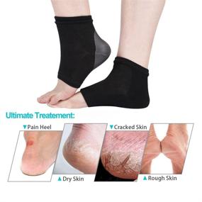 img 3 attached to KIKIMAX Moisturizing Heel Socks - 2 Pairs, Gel Lined, Toeless Spa Socks for Healing Dry, Hard Cracked Heels, Damaged Cuticles, and Callused Skin (Black and Grey)