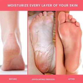 img 2 attached to MyFoot Foot Peel Mask, 2 Pack, Exfoliating Foot Treatment for Cracked & Dead Skin, Achieving Baby Smooth Feet, Enhanced with Olive Leaf Extract. (2 Pairs per Box)