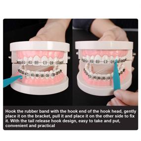 img 2 attached to Многозада́чный ортодонтический прибор для выравнивания зубов с портативными аксессуарами
