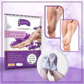 img 3 attached to Foot Peel Mask Peeling Soft