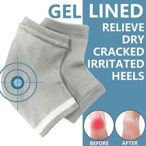 img 3 attached to 🧦 2 Pairs of Gel Toeless Moisturizing Heel Socks - Open Toe Vented Gel Spa Sleeves for Healing and Treating Dry Cracked Heels, Softening and Repairing - Black & Gray