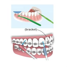 img 1 attached to 🔼 Interdental Angle Brush Picks for Back Teeth - Pack of 2 (20 each)