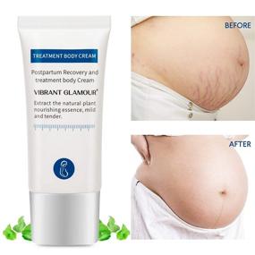img 3 attached to Organic Plant Extracts Stretch Mark Cream - Effective Pregnancy Skincare Treatment - Massage Cream for Stretch Marks & Scars - 0.5 Fl Oz