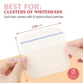 img 1 attached to AUSLKA Big Blemish Pimple Patches 10X10cm (6 Patches) - Hydrocolloid, Blemish Treatment Stickers, Cut Freely, Perfect for Pimples