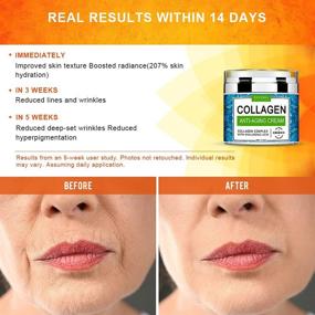 img 1 attached to 💆 Rejuvenating Collagen Cream for Face - Day and Night Retinol Moisturizers with Hyaluronic Acid & Vitamin C, Enhance Skin Texture & Glow, Powerful Moisturizer, Collagen Booster for Optimal Results