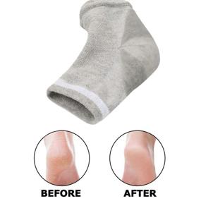 img 3 attached to 🧦 Runee Open Toe Moisturizing Gel Heel Socks - Treatment Care for Softer Heels, Dry, Hard, Rough, and Cracked Skin, 3 Pairs