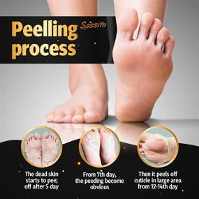 img 1 attached to 👣 Revitalizing Foot Peel Mask - 2-Pack - Exfoliating Lavender Scented Booties for Cracked Heels, Dead Skin, Calluses - Achieve Baby Soft Feet with this Powerful Formula