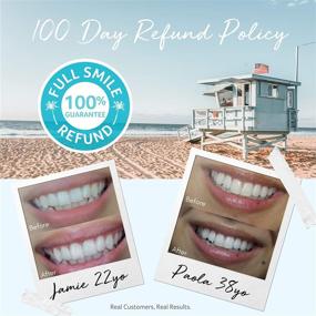 img 1 attached to Cali White Teeth Whitening Gel Refills: Natural, Vegan, Organic Whitener for Sensitive Tooth Bleach – Made 🦷 in USA with 35% Carbamide Peroxide – 3X 5mL Syringes for Use with UV or LED Light & Trays