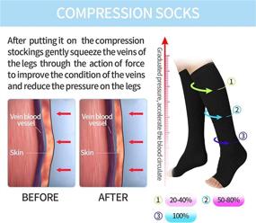 img 3 attached to 🧦 2 Pairs Compression Socks for Varicose Veins Prevention, Medical Toeless Support Hose 20-30mmHg for Women and Men