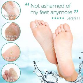 img 3 attached to 👣 Foot Peel Mask: Say Goodbye to Cracked Heels and Calluses - Get Baby Soft Feet with this Exfoliating Peeling Natural Treatment! (2 Pack, Women's 5-11)