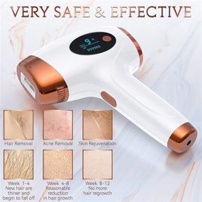 img 1 attached to 💫 IPL Hair Removal - Laser Permanent Hair Removal Device for Women and Men, 999900 Flashes UPGRADED At-Home Treatment for Facial Legs Arms Whole Body