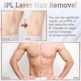 img 2 attached to 💫 IPL Hair Removal - Laser Permanent Hair Removal Device for Women and Men, 999900 Flashes UPGRADED At-Home Treatment for Facial Legs Arms Whole Body