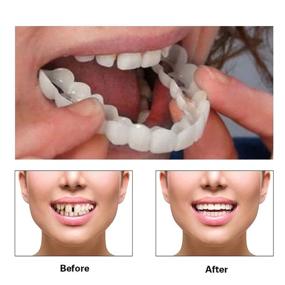 img 2 attached to Veneer Instant Veneers Dentures Confident
