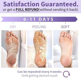img 1 attached to 3-Pack Foot Peel Mask: Eliminate Dry Dead Skin, Calluses, and Cracked Heels – Exfoliating Treatment for Baby Soft and Smooth Skin – Moisturizing Care – Men and Women's Foot Peeling Mask