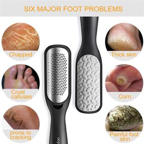 img 1 attached to 🦶 Effective Foot Callus Remover: Colossal Foot Rasp & Professional Scrubber Kit to Remove Hard Skin, Wet & Dry Feet - Surgical Grade Stainless Steel File (Black & Silvery)