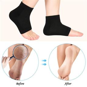 img 3 attached to 🧦 Bememo Soft Ventilate Gel Heel Socks Open Toe Socks for Dry Hard Cracked Skin – Moisturizing Day Night Care Skin, Pack of 3 Pairs (Black, White, Grey)