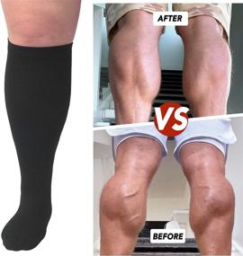 img 2 attached to 🧦 Highly Effective Plus Size Compression Socks: 20-30 mmHg Circulation Support for Wide Calf Men and Women - Ideal for Recovery!