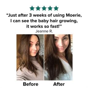 img 1 attached to Moerie Mineral Hair Growth & Repair Mask – Restorative Treatment Hair Mask – Hair Treatment For Longer, Thicker, Fuller Hair - Vegan & Paraben Free – 3.4 oz (96.4g)