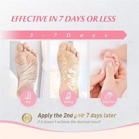 img 3 attached to 🦶 Cezivy Exfoliating and Deodorizing Foot Mask - Peel Away Dead Skin, Calluses, and Crack Heels - Reclaim Your Baby Soft Feet, No Need for Callus Remover (2 Pairs)