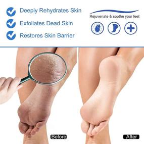 img 1 attached to 🦶 Natural Foot Repair Cream for Dry Cracked Feet - Moisturizes, Nourishes, Softens Rough Dead Skin - Makes Feet Smooth - 1.7 fl oz