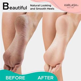 img 1 attached to 👣 Karlash 2-Sided Nickel Foot File for Effective Callus Trimming and Removal, Mint (Single Pack)