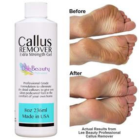 img 3 attached to Extra Strength Gel for Feet - Lee Beauty Professional Callus Remover, Achieve At-Home Pedicure Results with 8 Oz Size